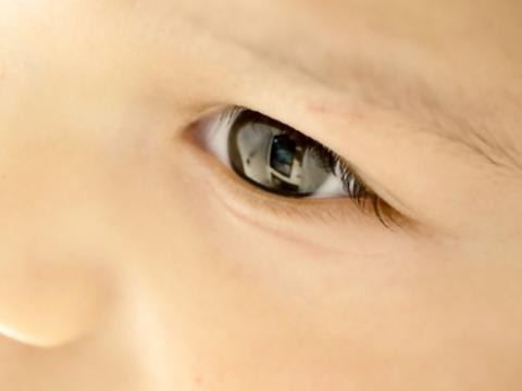 Baby's eye