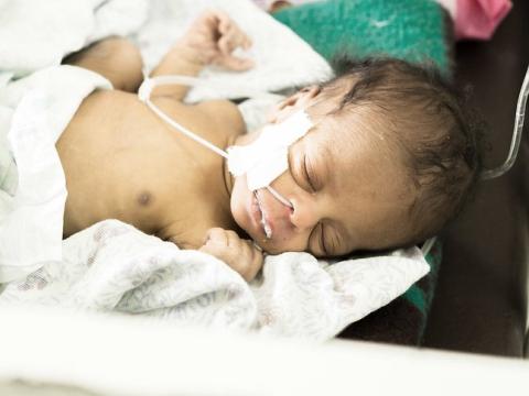 Baby being treated for sepsis