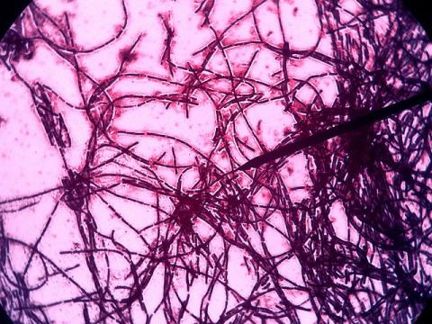 Bacillus subtillis