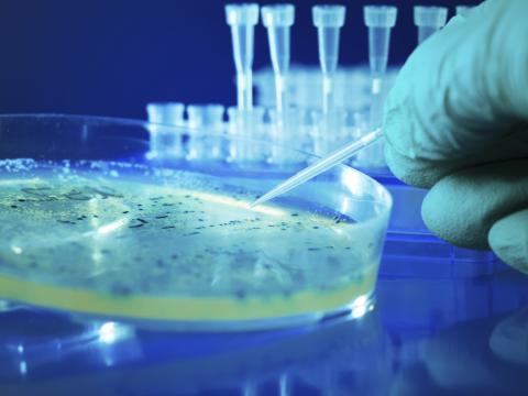 bacteria culture