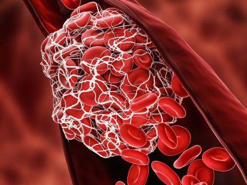 Blood clot illustration