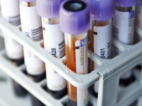 Blood samples in tubes