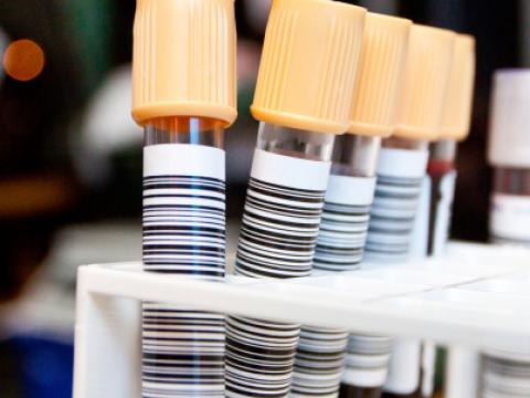 Vials of blood