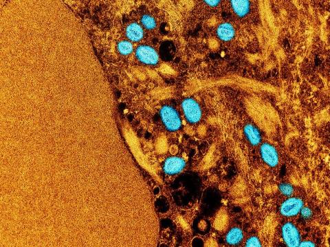 Monkeypox viruses, in blue