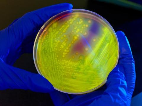Clostridium difficile in petri dish