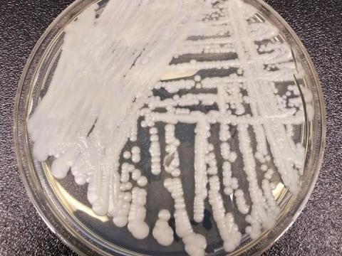 Candida auris