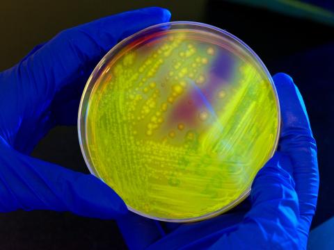 Clostridium difficile on agar plate