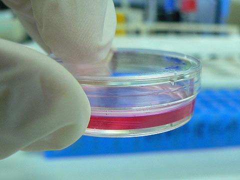 Cell culture