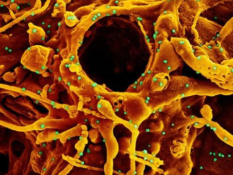Colorized microscope image of SARS-CoV-2