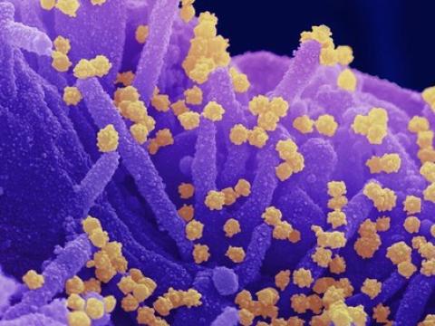 SARS-CoV-2 viruses highly magnified