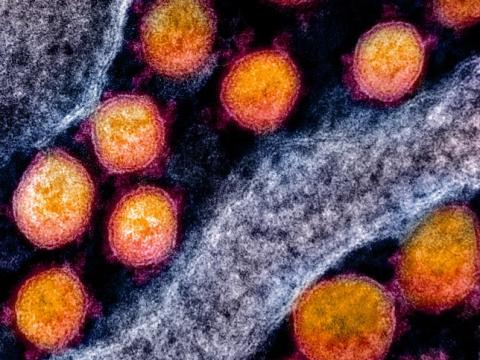 COVID-19 coronaviruses