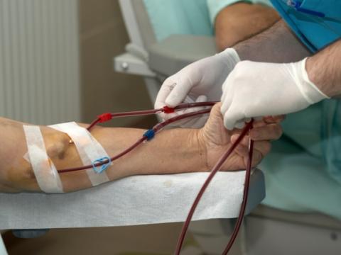 Dialysis