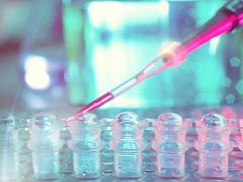DNA amplification test