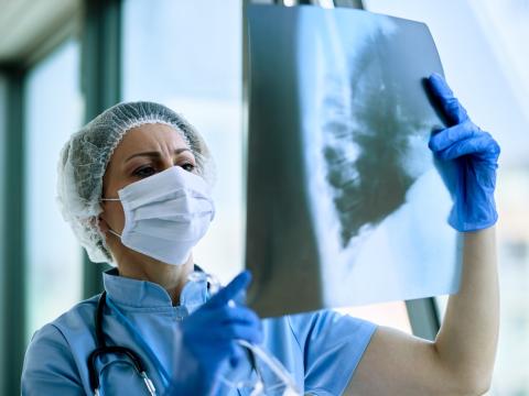 Doctor examining chest x-ray
