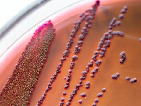 E coli colony on petri dish