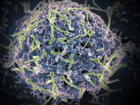 Ebola virus