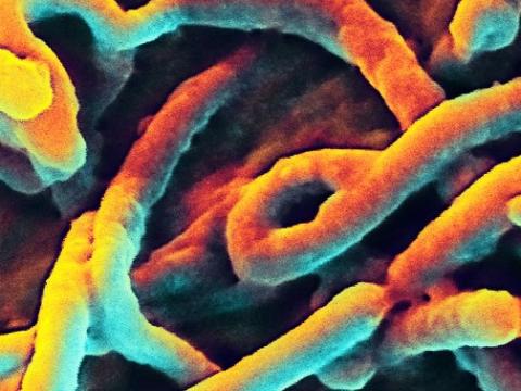 Ebola virus under the microscope