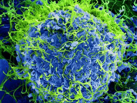Ebola virus particles