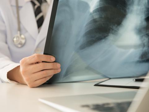 Examining chest x-ray
