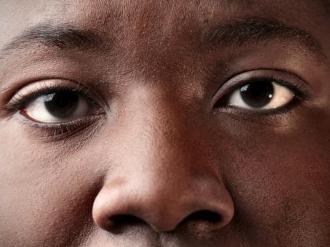 eyes