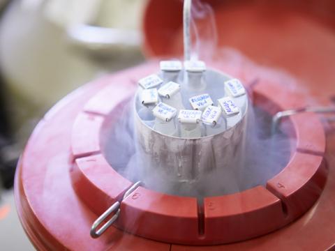 Sperm bank frozen storage