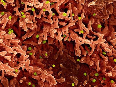 Green monkeypox viruses infecting red cells