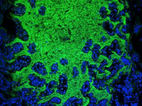 Gut bacteria