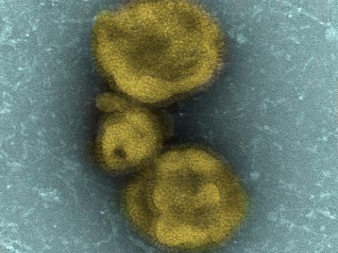 H7N9 virus