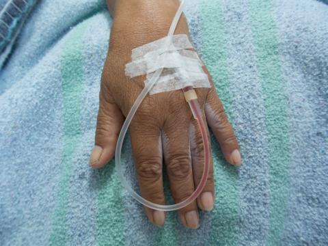 Hand with IV port