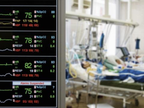 ICU monitor