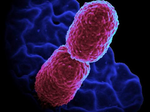 Klebsiella pneumoniae