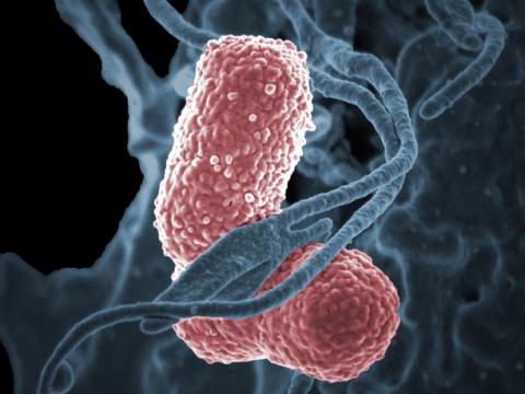 Klebsiella pneumoniae