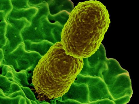 Klebsiella pneumoniae