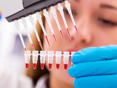 Lab pipetting