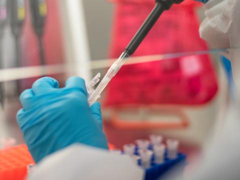 Lab research
