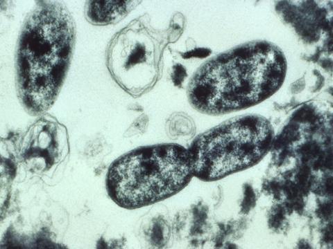 Legionella bacteria under microscope