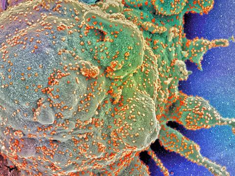 COVID-19 viruses under microscope