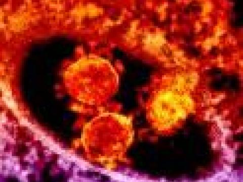 MERS-CoV micrograph