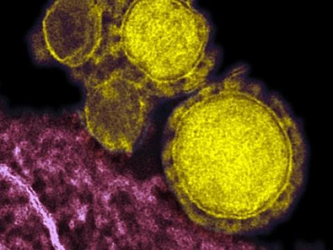 MERS virus