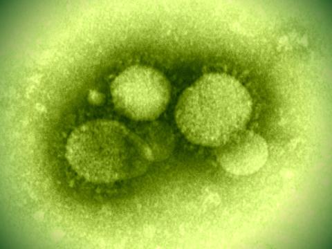 MERS virus