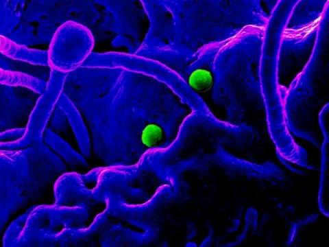 MERS virus particles