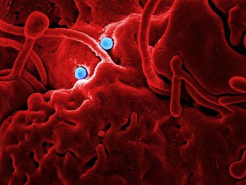 MERS virus particles