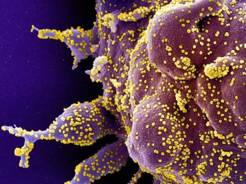 SARS-CoV-2 highly magnified