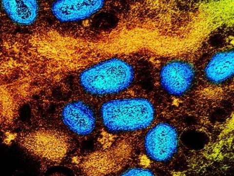 Monkeypox viruses under the microscope