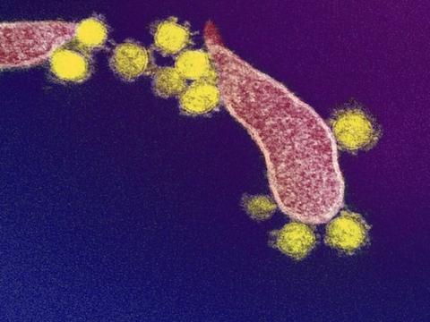 SARS-CoV-2 viruses under the microscope