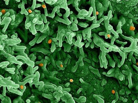 Monkeypox virus infecting cells