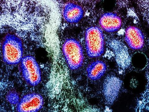Monkeypox viruses highly magnified