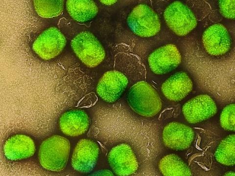 Monkeypox viruses highly magnified