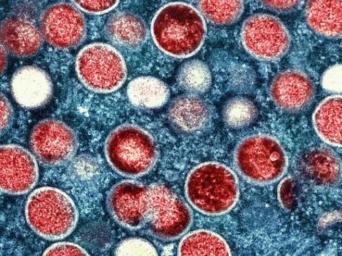 Monkeypox viruses under the microscope