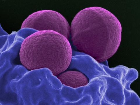 MRSA bacteria